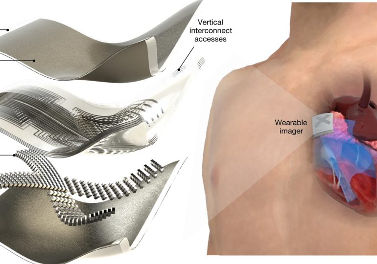 Wearable ultrasound patch could offer real-time heart scans on the go